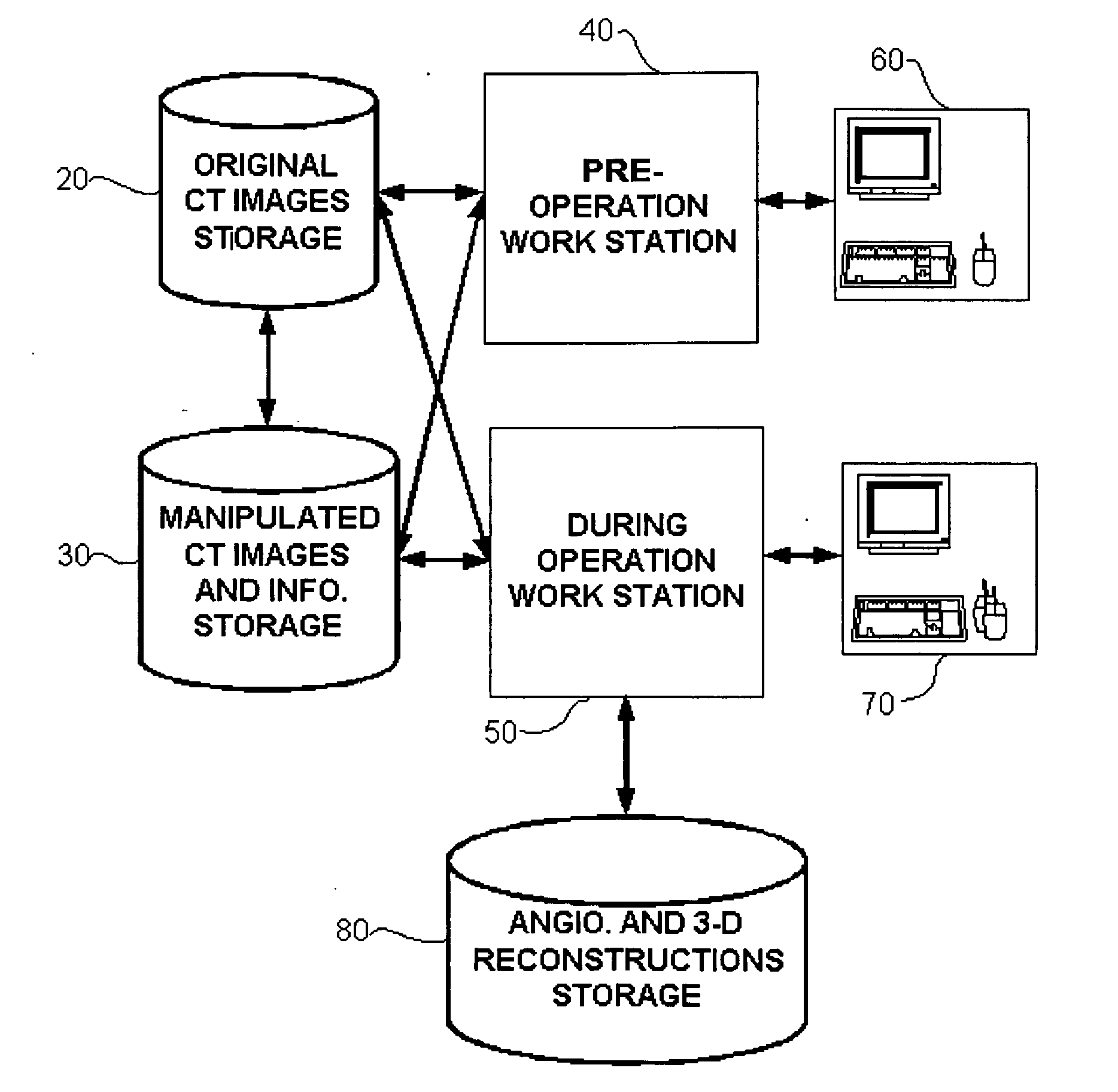 Apparatus and method for fusion and in-operating-room presentation of volumetric data and 3-D angiographic data