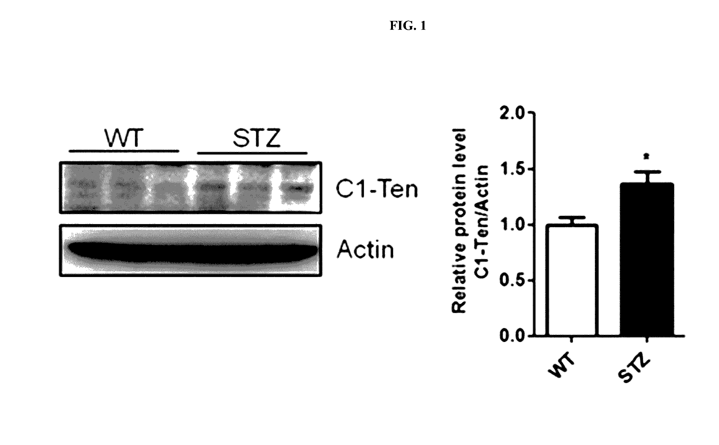 Pharmaceutical compositions for preventing or treating diabetic nephropathy comprising the activity inhibitor of tenc1