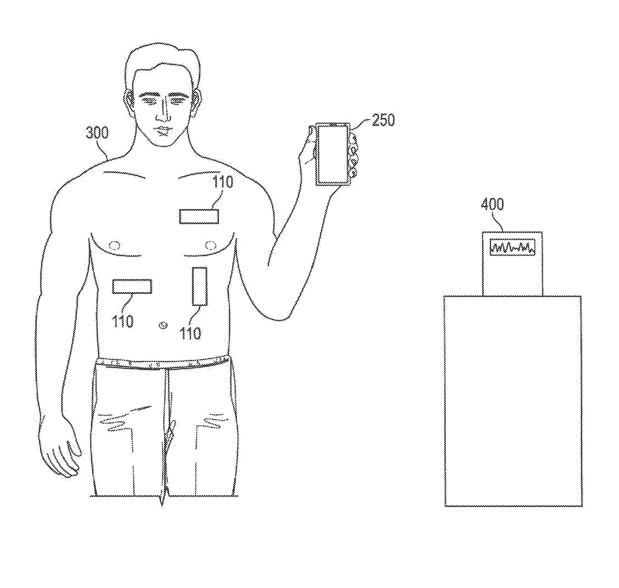 Wireless ECG sensor system and method