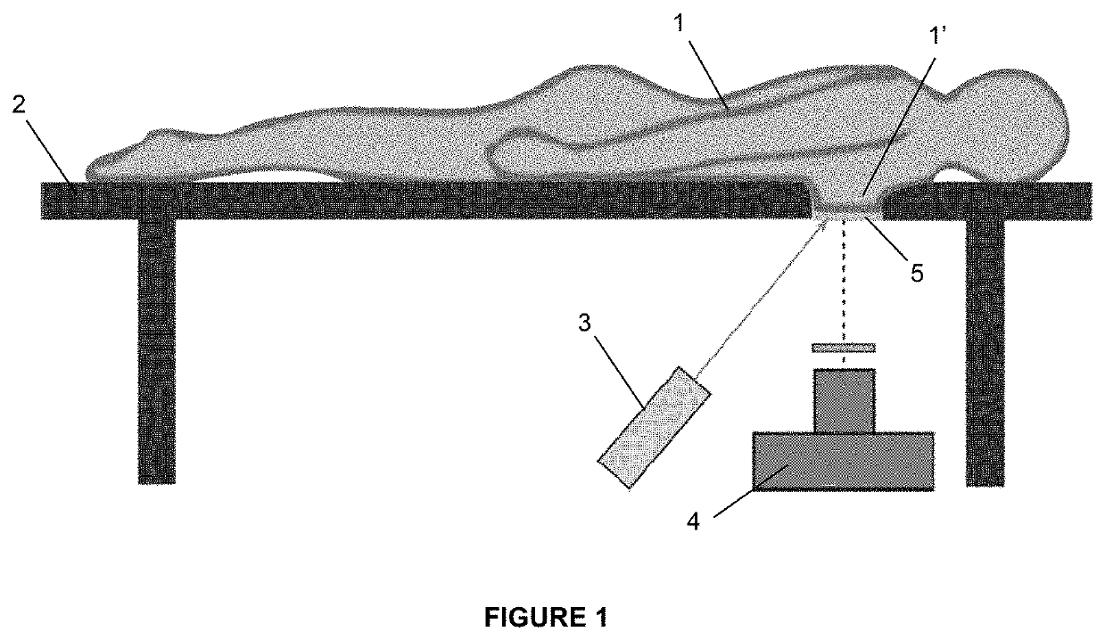 Optical mammograph using near-infrared in diffuse reflectance geometry