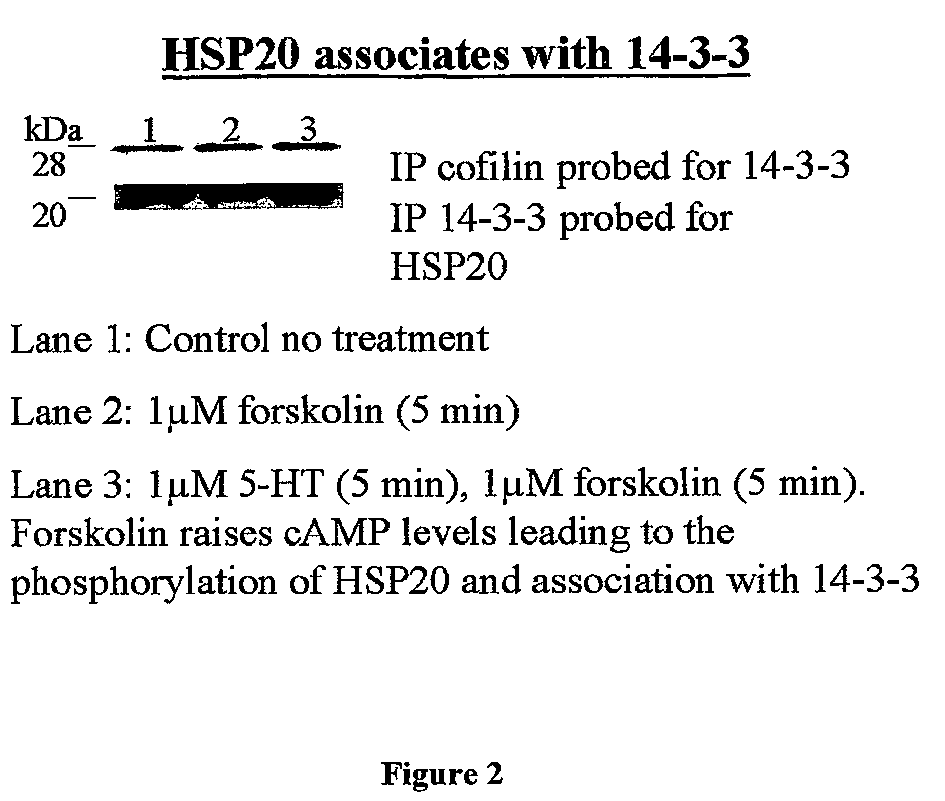 Heat shock protein 20-related polypeptides and uses therefor