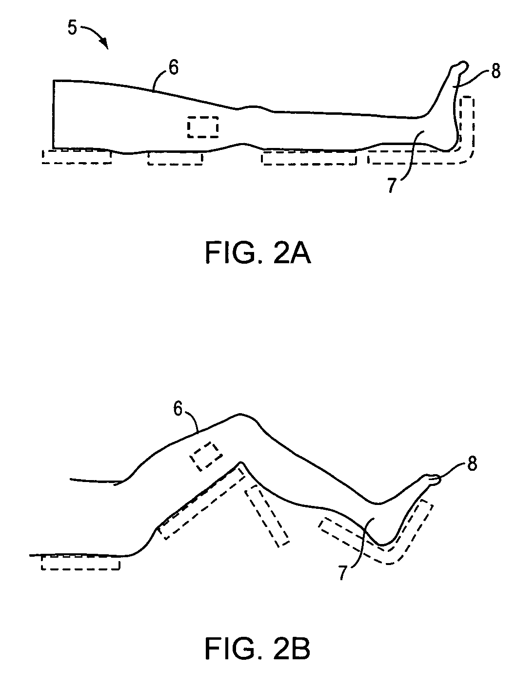 Method and apparatus for aligning a knee for surgery or the like