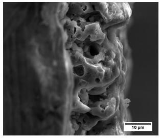 A method for preparing porous bioceramic membranes by micro-arc oxidation