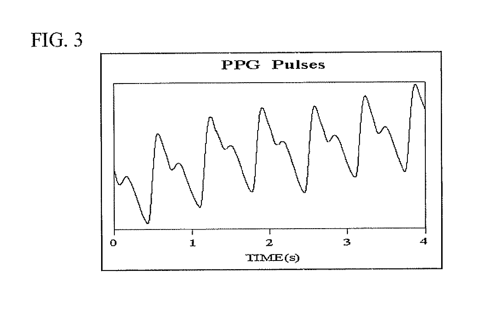 Modified Pulse Oximetry Technique For Measurement Of Oxygen Saturation In Arterial And Venous Blood