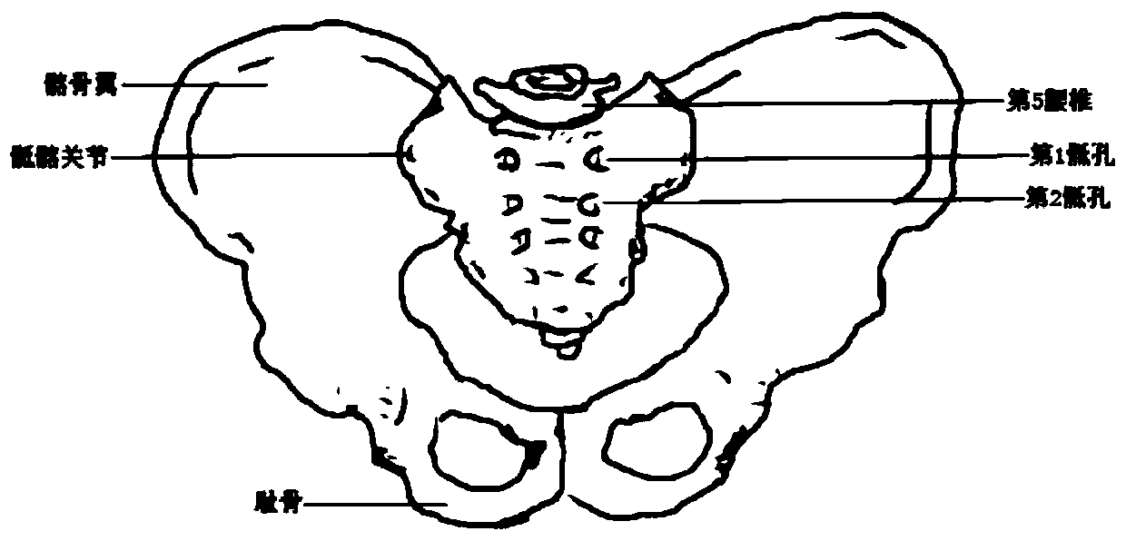 Sacroiliac joint through-screw positioning coaxial guide and assembly thereof