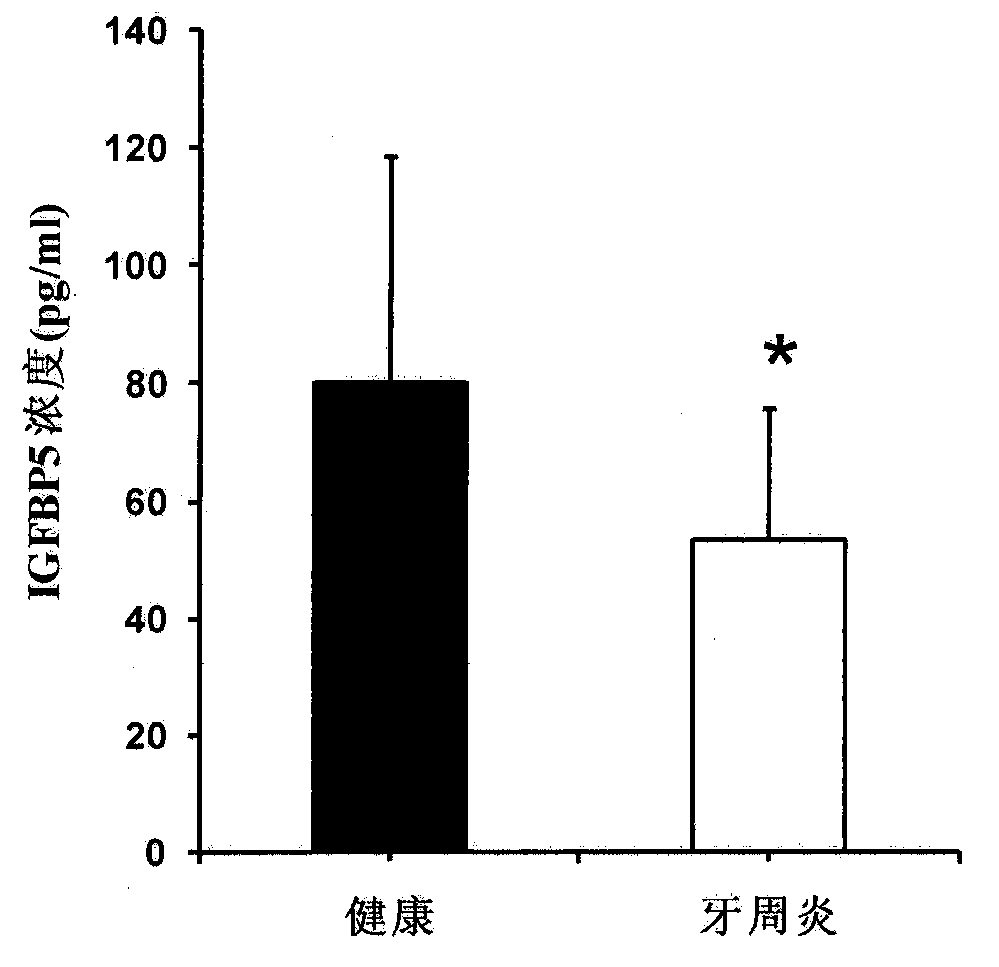 Application of insulin-like growth factor binding protein 5 in promotion of periodontal tissue regeneration