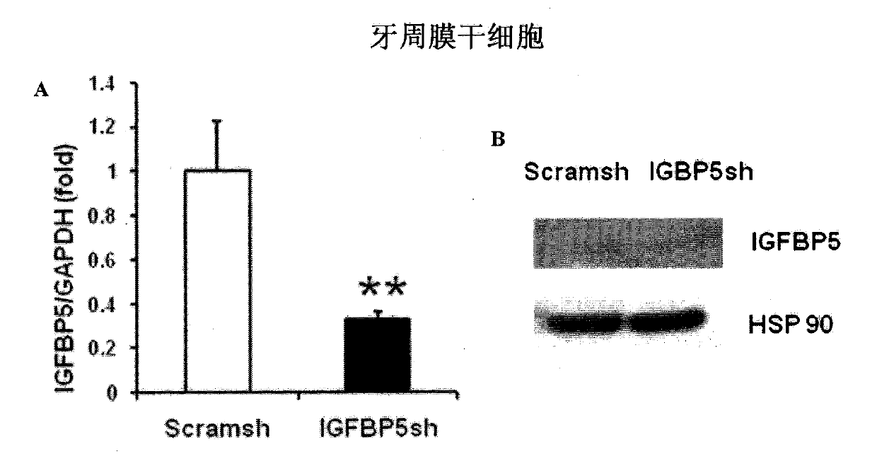 Application of insulin-like growth factor binding protein 5 in promotion of periodontal tissue regeneration