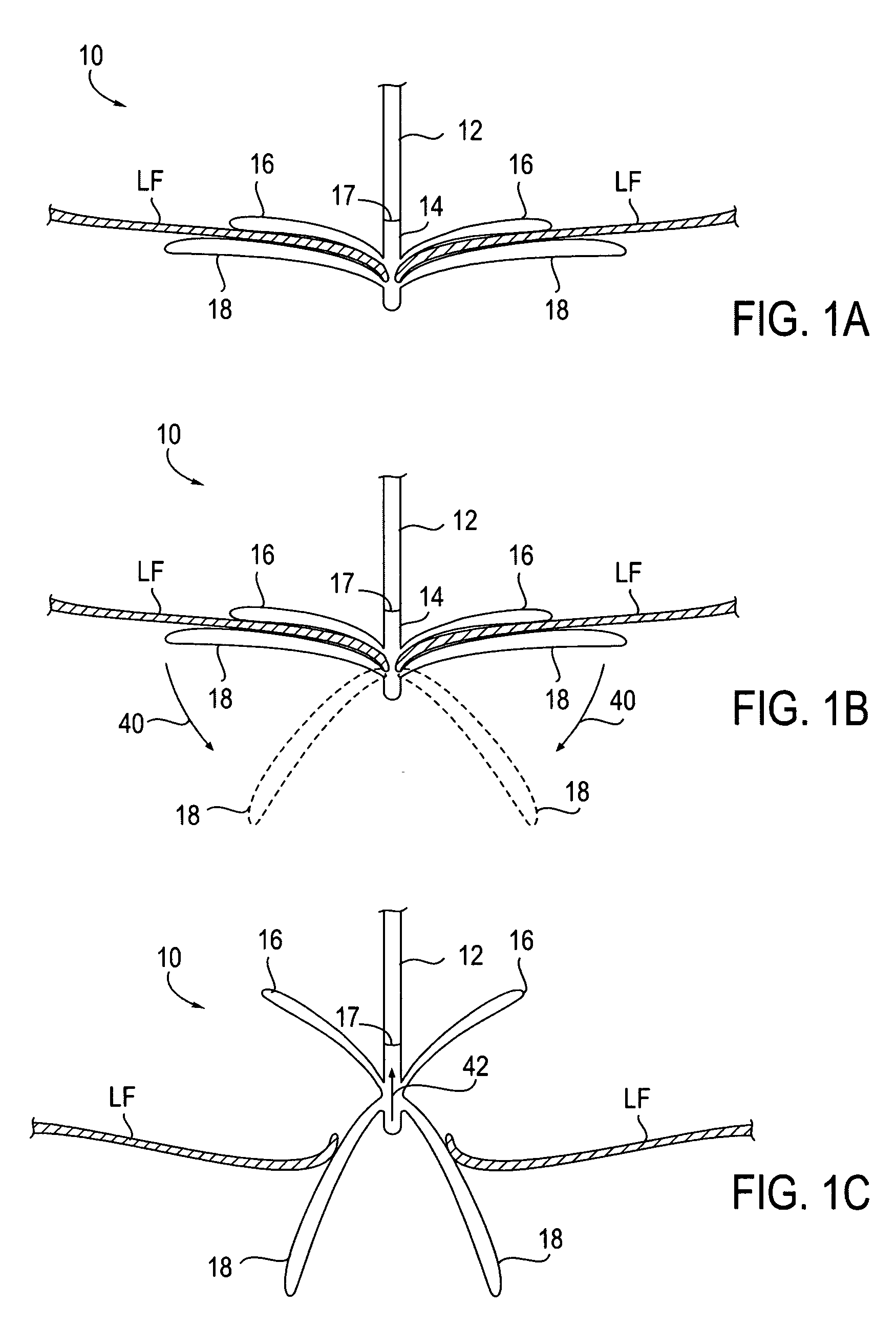 Fixation devices for variation in engagement of tissue