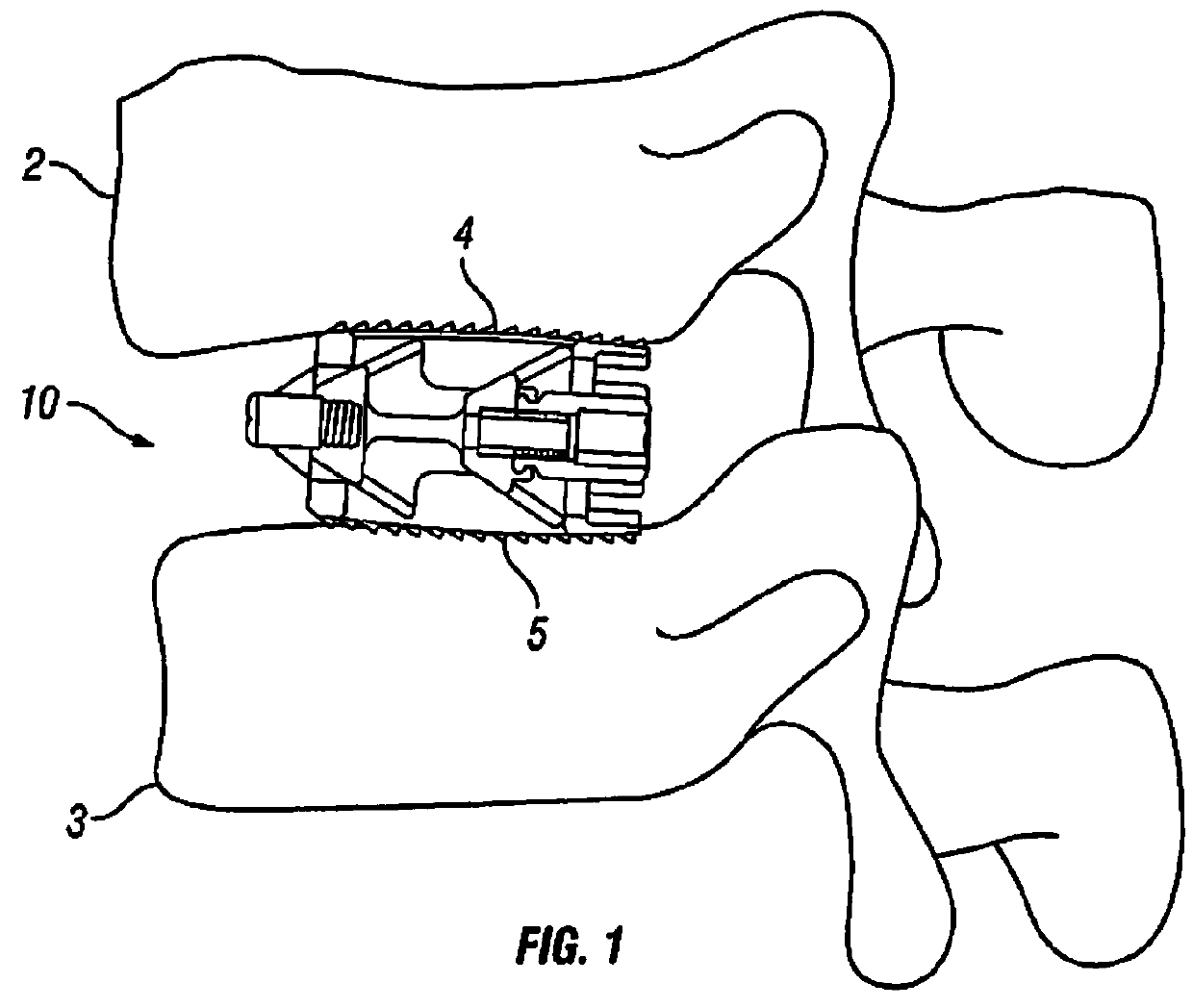 Expandable fusion device and method of installation thereof