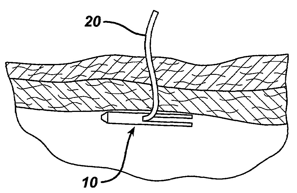 Methods and devices for delivering and applying suture anchors