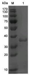 Algin lyase having heat recovery characteristic and application of algin lyase