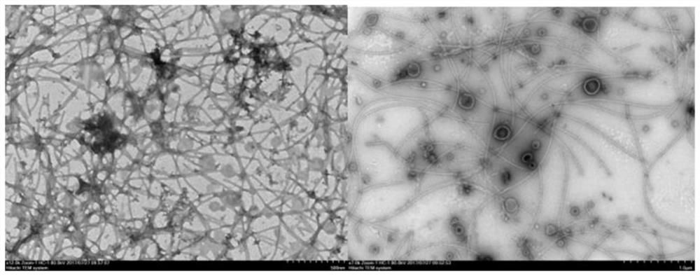 A kind of extraction method of Salmonella typhimurium outer membrane vesicle