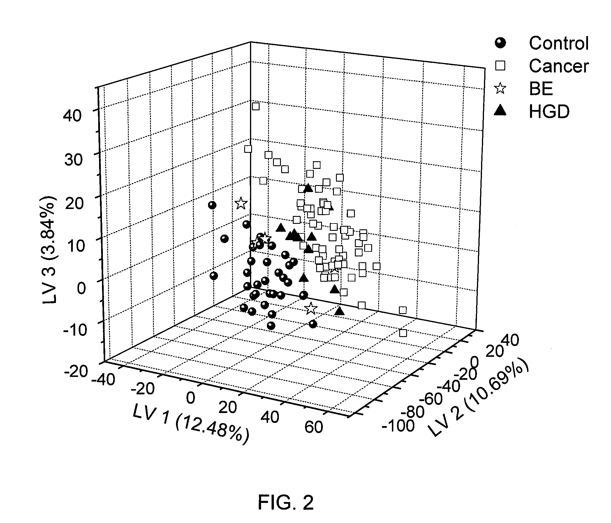 Metabolite biomarkers for the detection of esophageal cancer using NMR