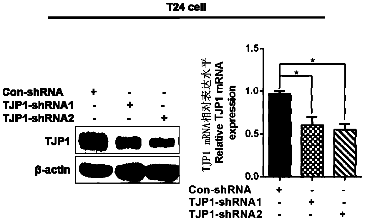 Bladder cancer biomarker TJP1 and application thereof