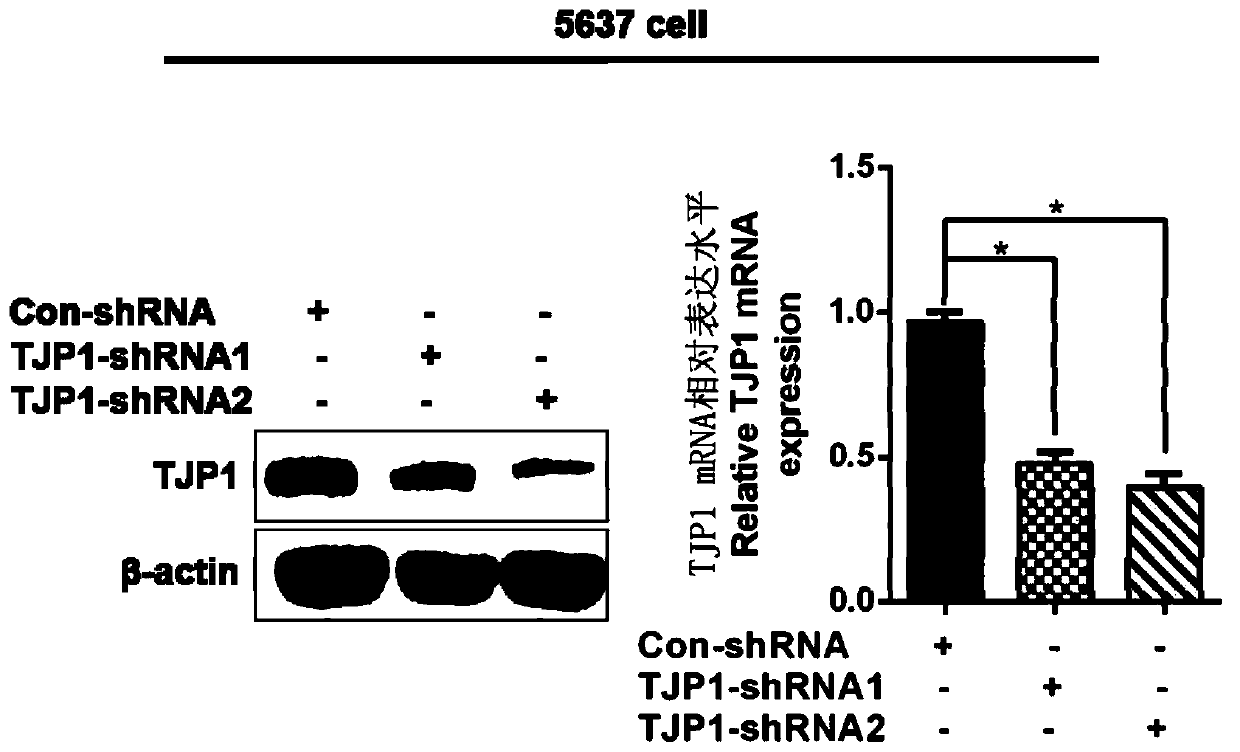 Bladder cancer biomarker TJP1 and application thereof