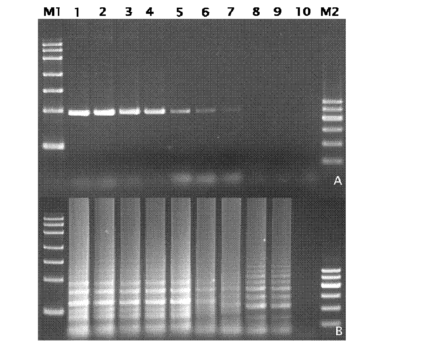 Method for detecting apple viruses by adopting reverse transcription loop-mediated isothermal amplification technology