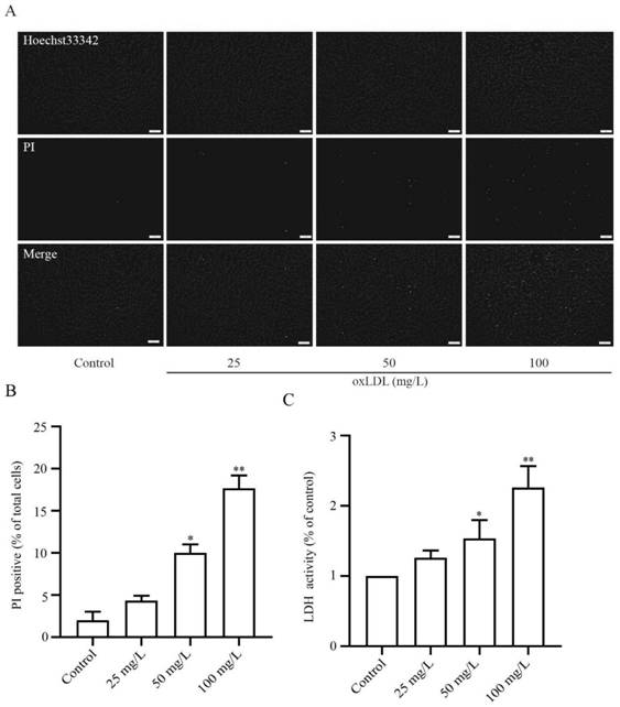 Application of GYY4137 in preparation of drugs for inhibiting pyroptosis of vascular endothelial cells