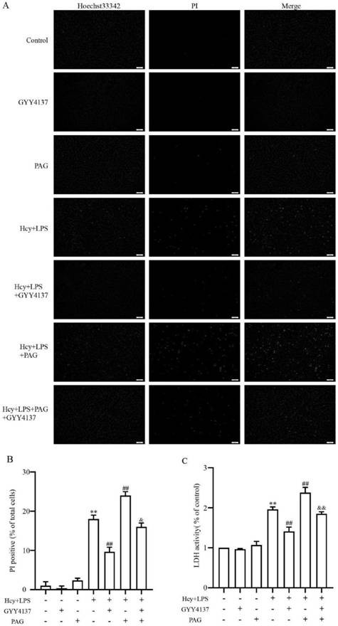 Application of GYY4137 in preparation of drugs for inhibiting pyroptosis of vascular endothelial cells