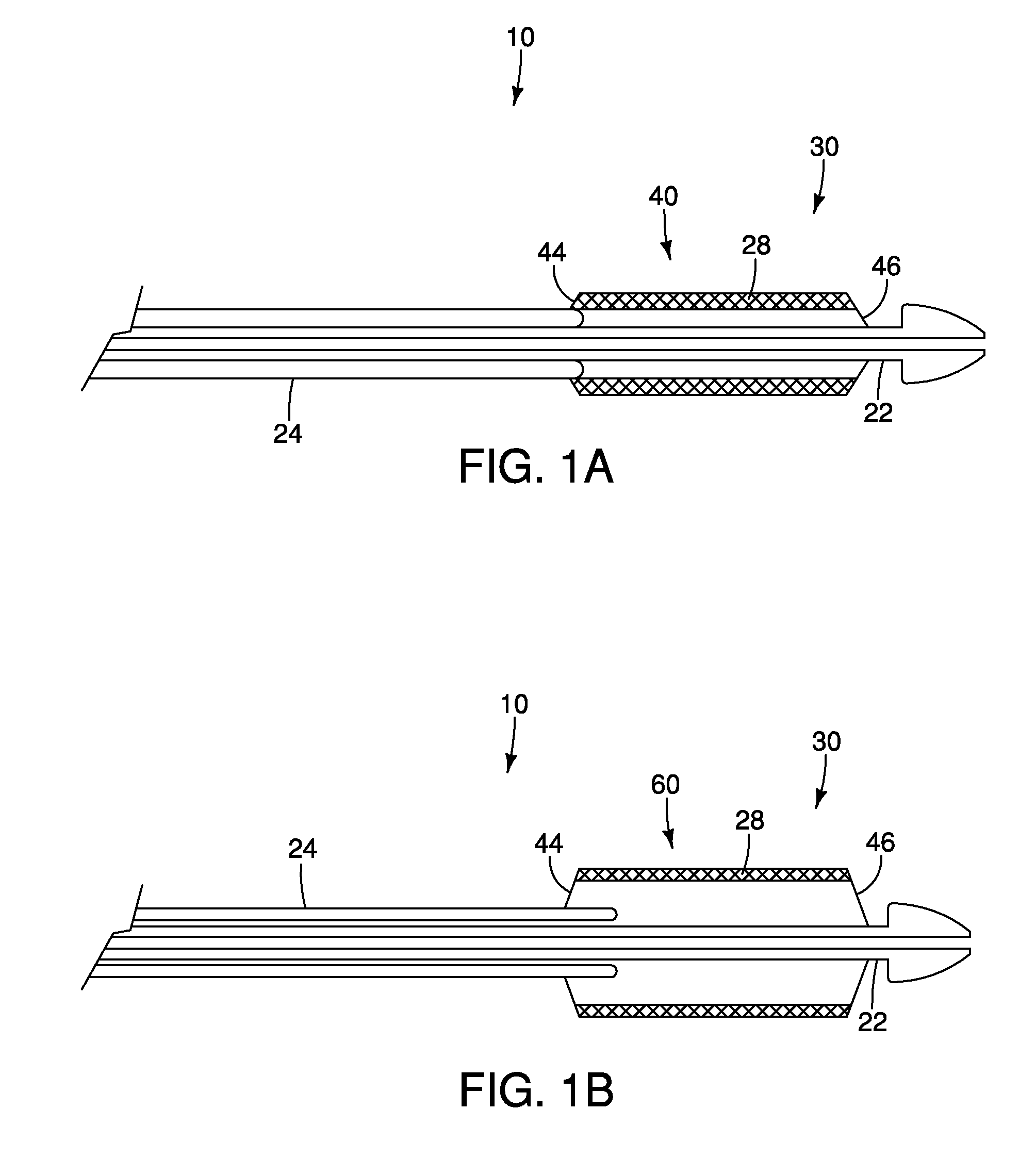 Control System for a Stent Delivery System