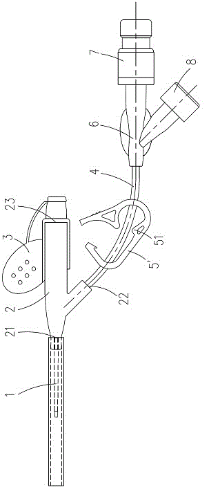 continuous positive pressure intravenous catheter