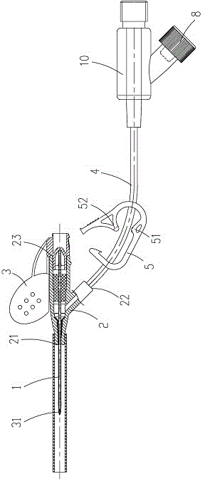 continuous positive pressure intravenous catheter