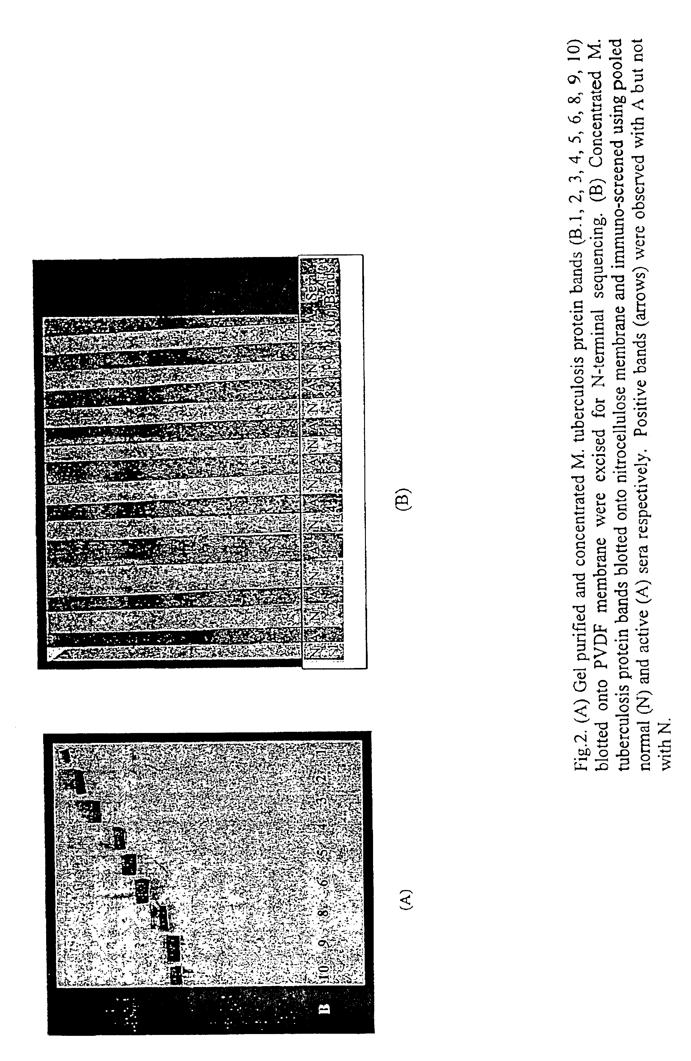Bacterial-derived molecules and therapeutic and diagnostic uses therefor