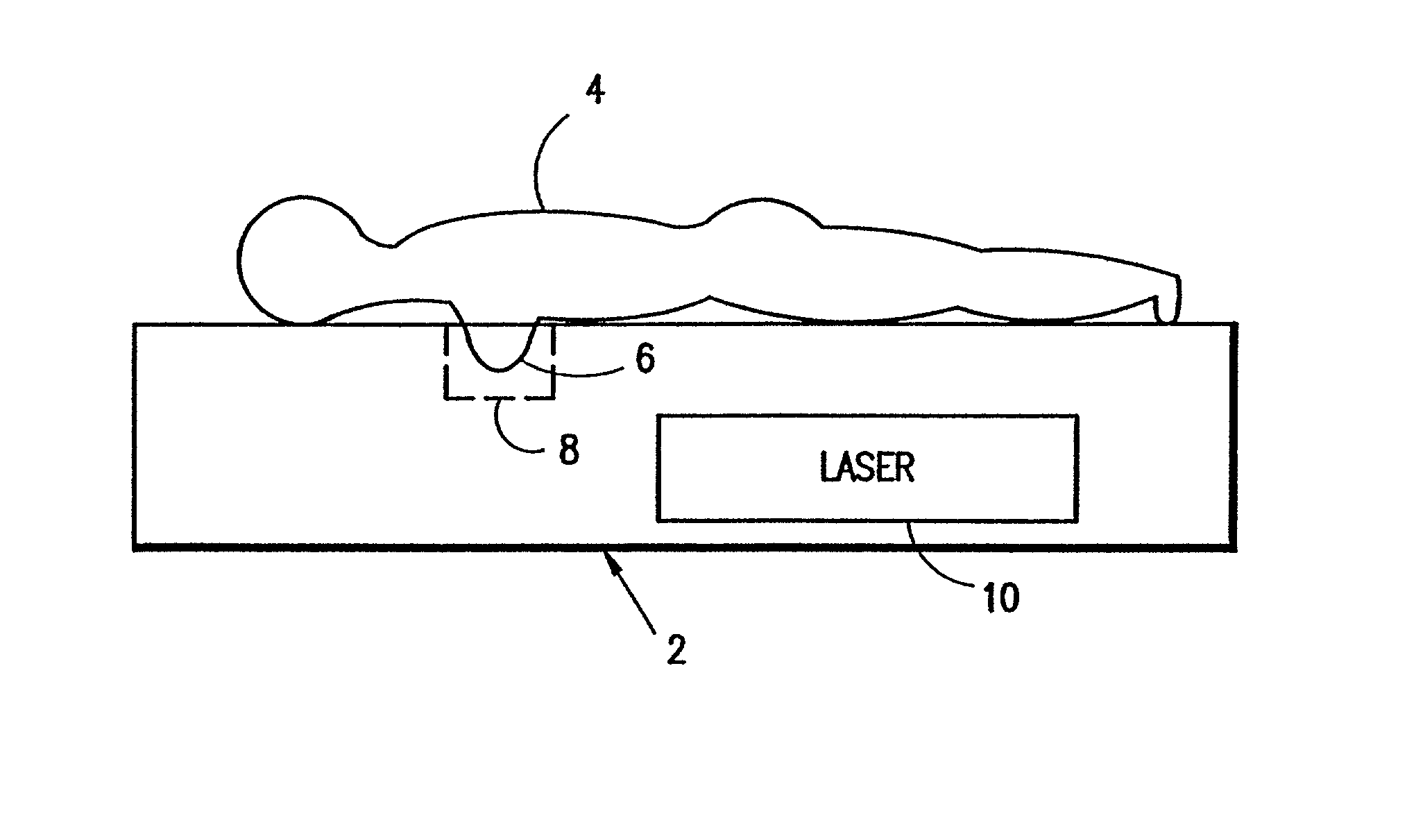 Detector array for use in a laser imaging apparatus