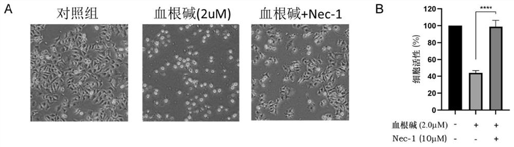 Application of sanguinarine in preparation of RIPK3 activator