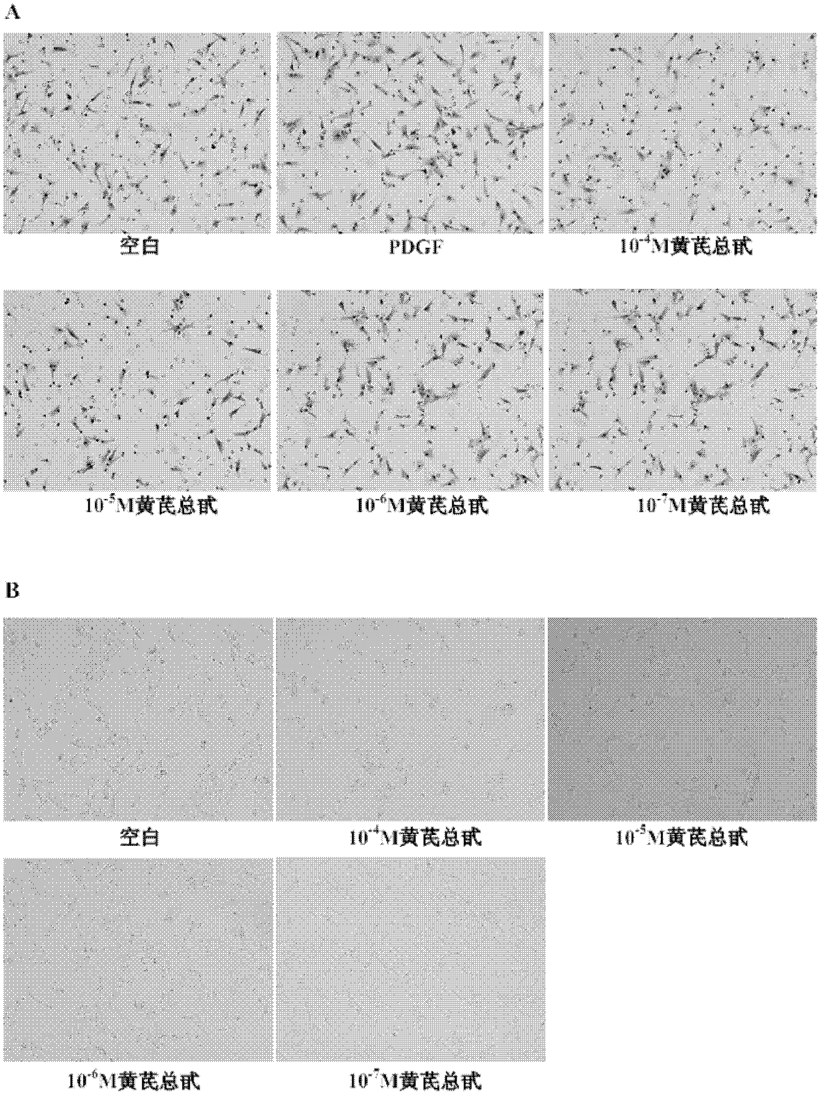 Application of astragalosides in hepatic stellate cell migration inhibition drug preparation