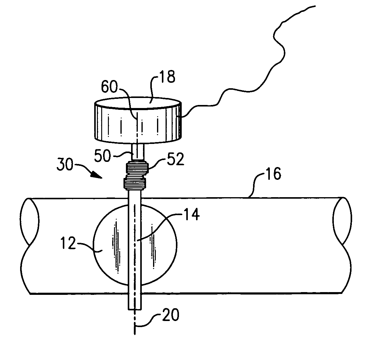 Side loaded valve assembly