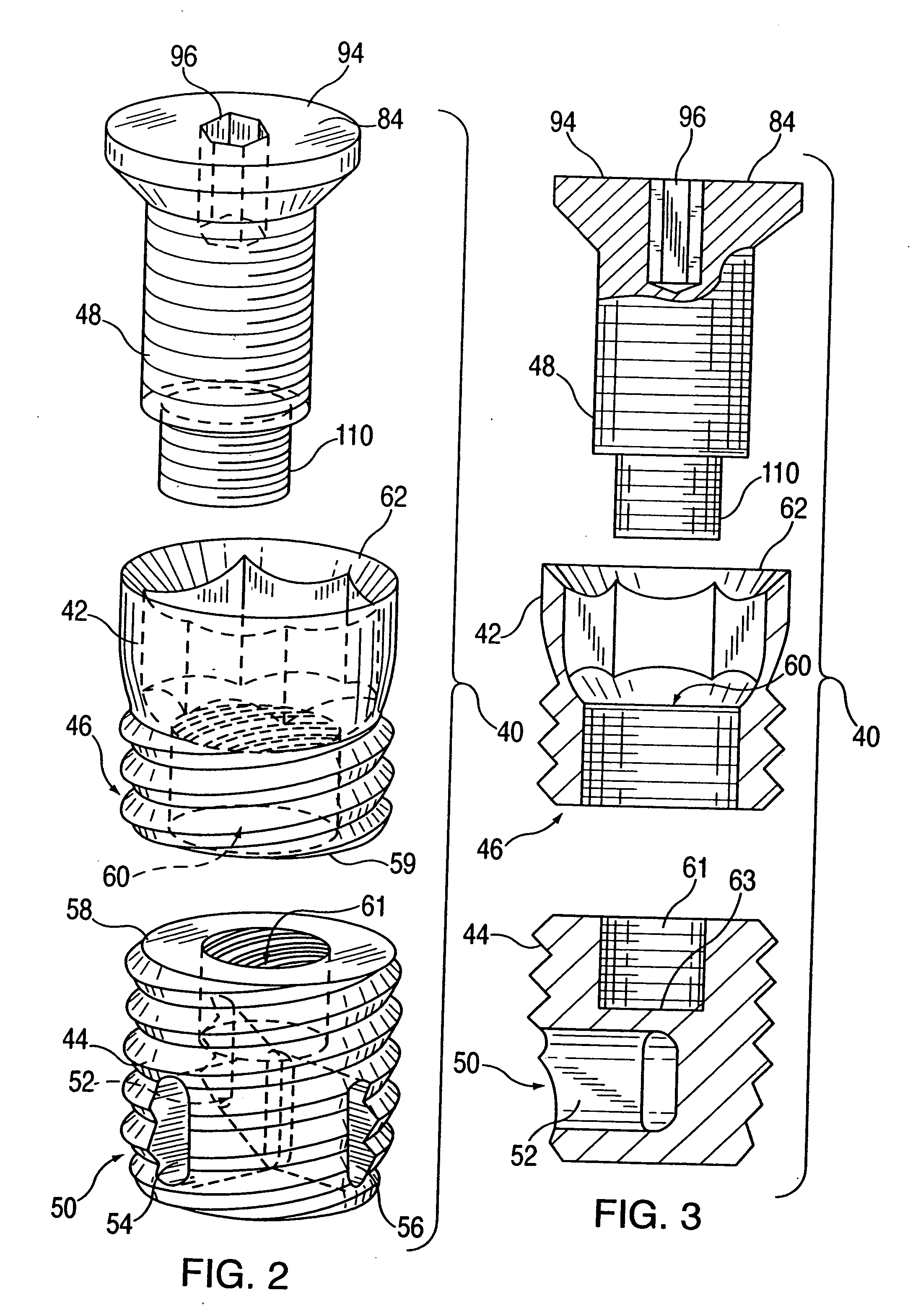Combination distraction dental implant and method of use