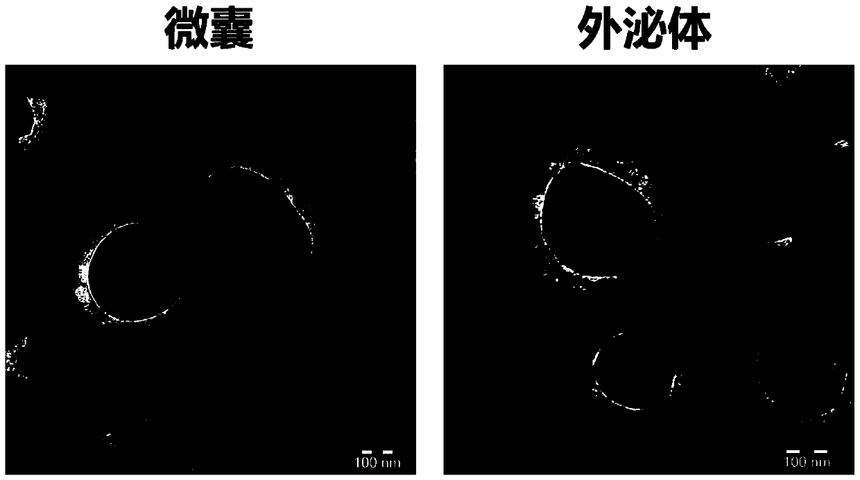 Cell microcapsule and preparation method thereof, cell microcapsule loaded with cancer resisting medicines, and preparation method and application of cell microcapsule loaded with cancer resisting medicines