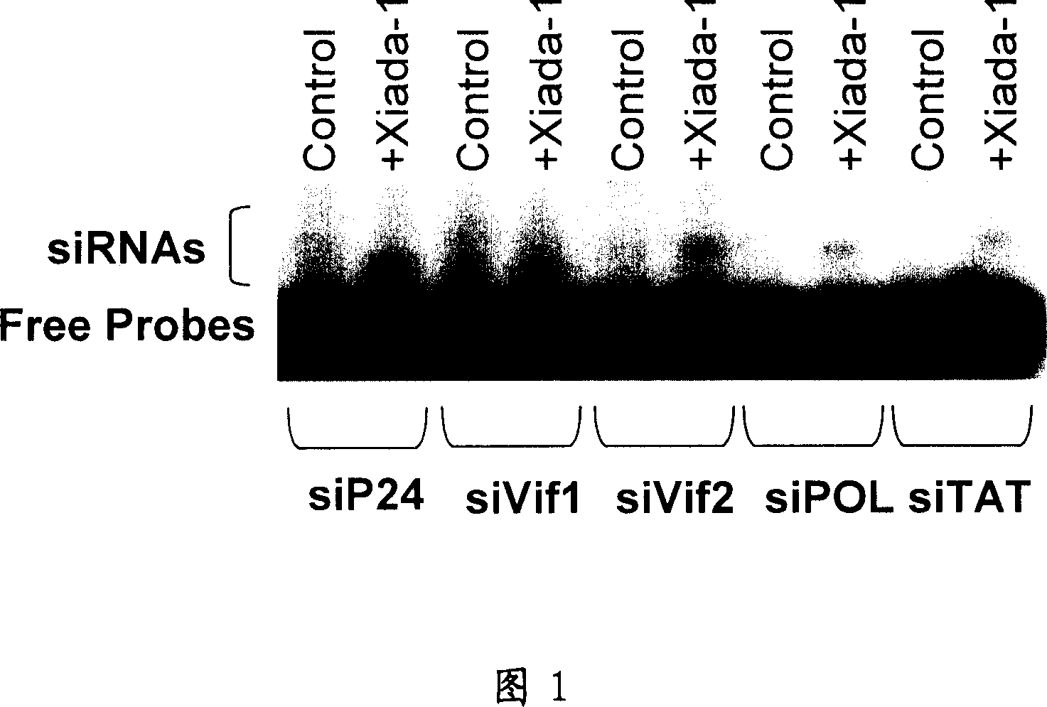 Recombination expression carrier for treating Aids, reformed blood building stem cell and method