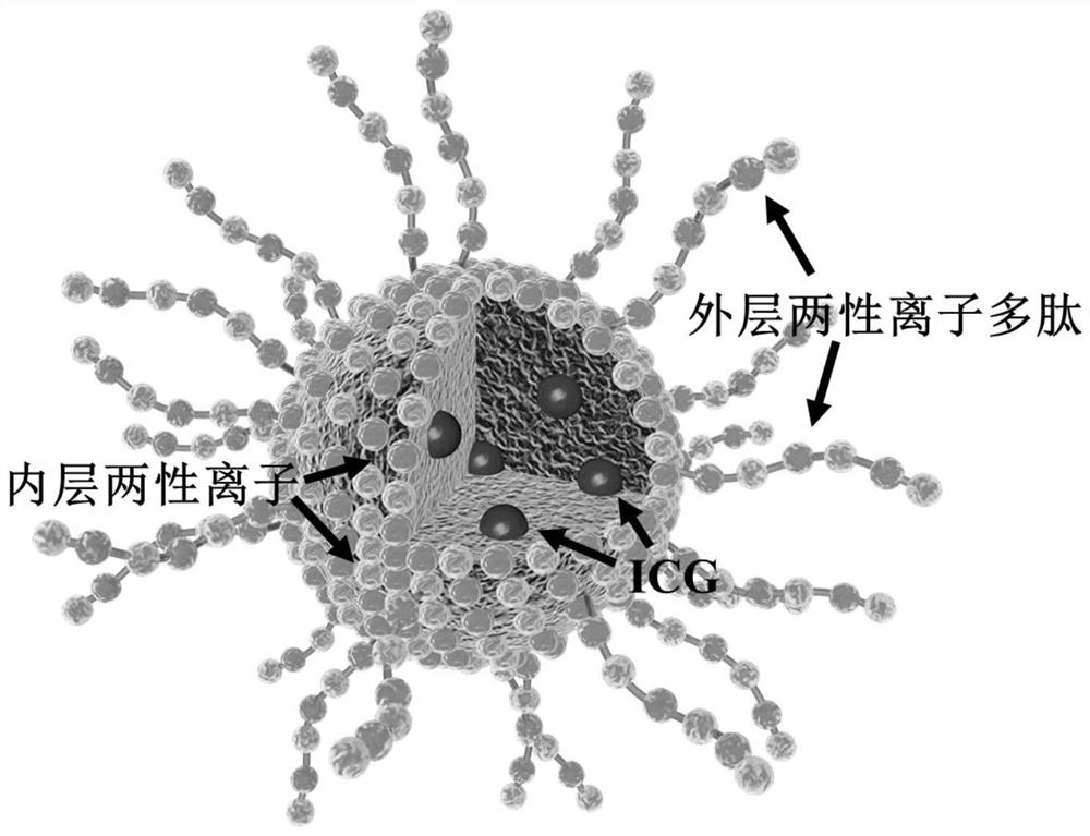 A kind of indocyanine green nano medicine and preparation method thereof