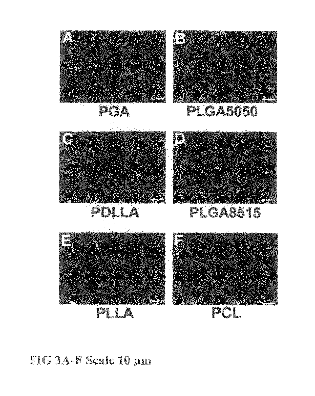 Tissue engineered cartilage, method of making same, therapeutic and cosmetic surgical applications using same