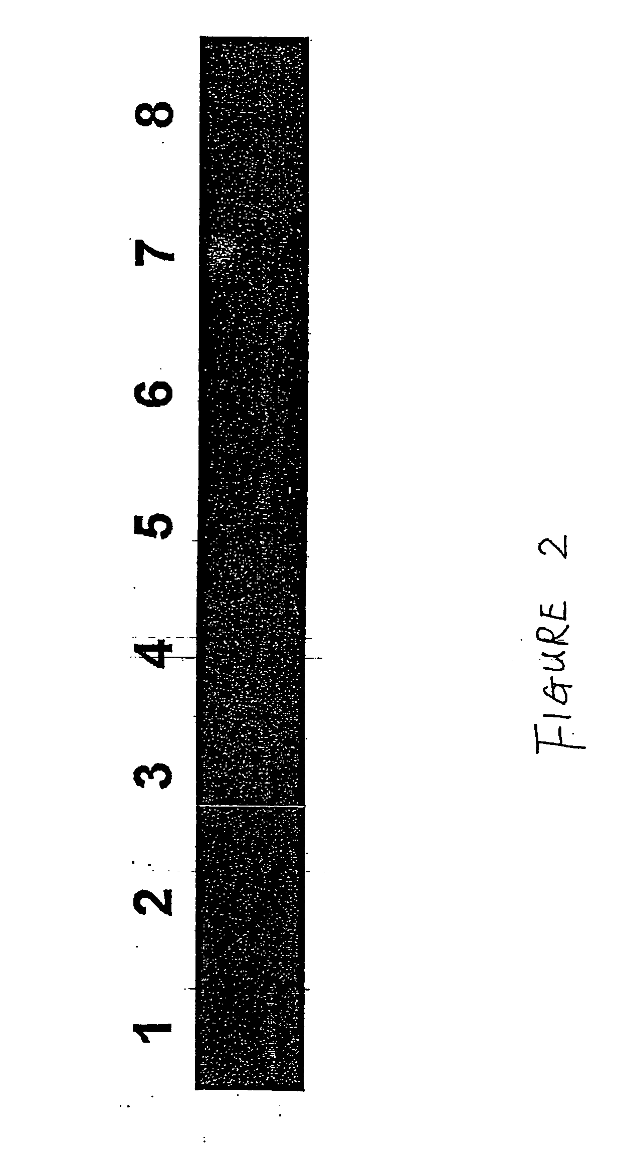 Method for the detection of coronary artery disease related gene transcripts in blood