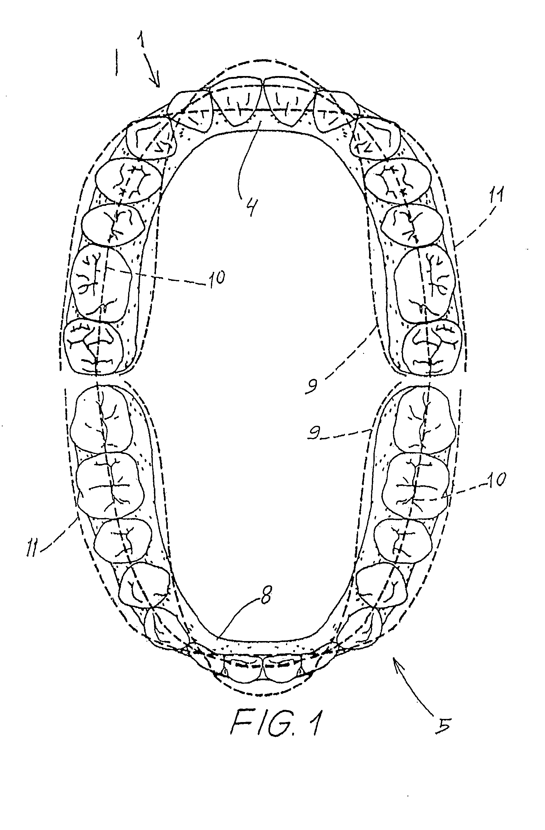 Set of prefabricated and flexible dental arches with adjustable teeth, dental arches kit, denture construction process and method of application of said arches in the denture construction process