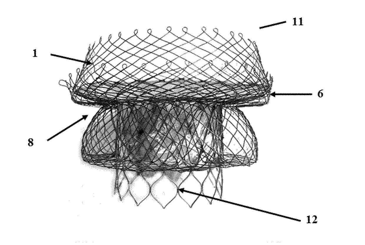 Heart valve anchoring device