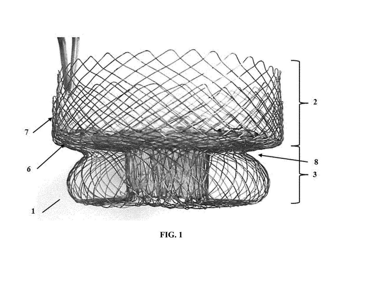 Heart valve anchoring device