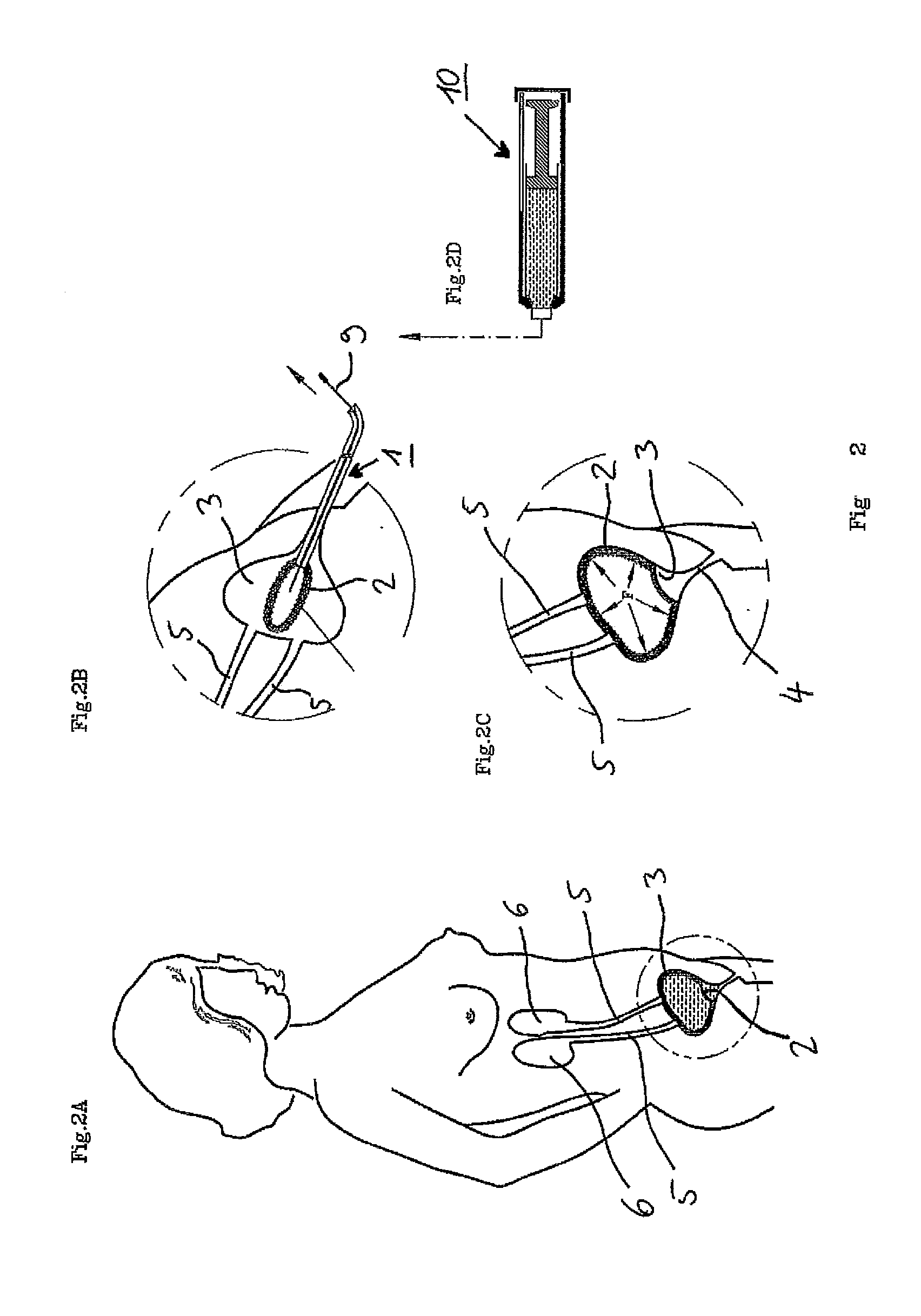 Device for protecting and cleaning the bladder lumen