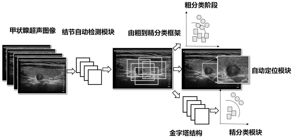 Diagnosis system of thyroid ultrasound image nodules based on multi-scale convolutional neural network