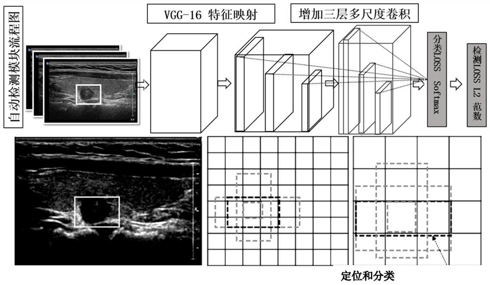 Diagnosis system of thyroid ultrasound image nodules based on multi-scale convolutional neural network