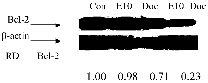 Pharmaceutical composition and application of pharmaceutical composition in preparation of medicine for resisting prostate cancer