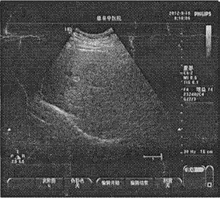 Traditional Chinese medicament composition and tablets for preventing and treating hepatic cirrhosis and preparation method for traditional Chinese medicament composition