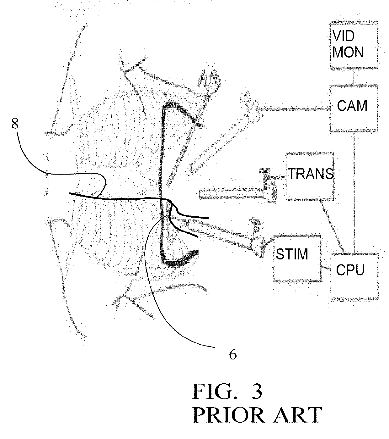 Non-Invasive Handling of Sleep Apnea, Snoring and Emergency Situations