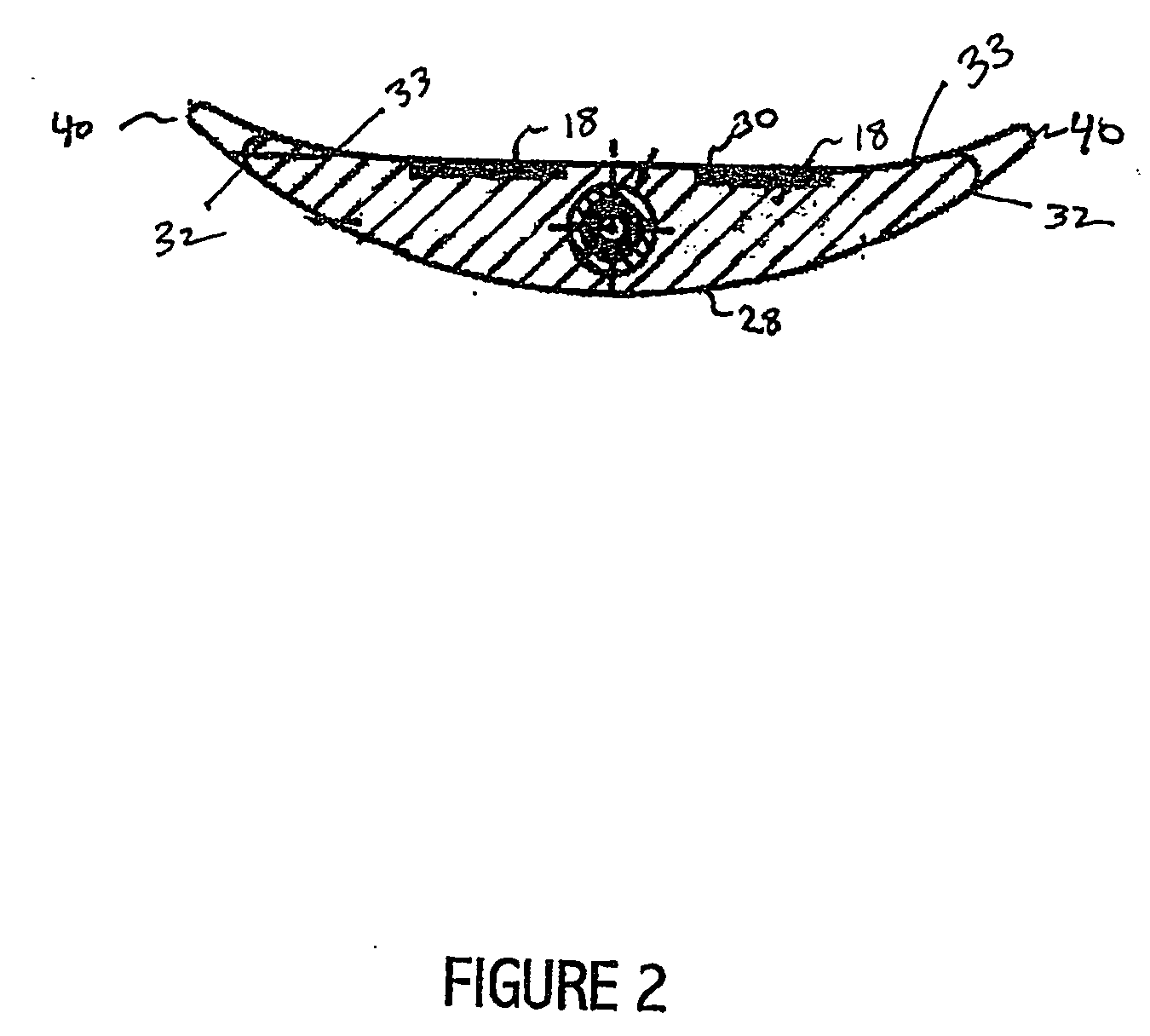 Winged electrode body for spinal cord stimulation