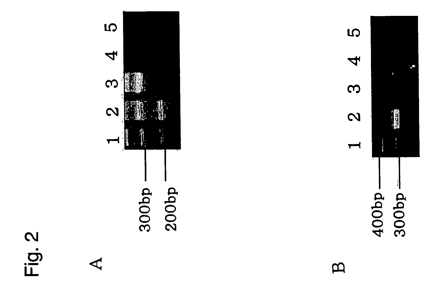 Method of forming pancreatic beta cells from mesenchymal cells