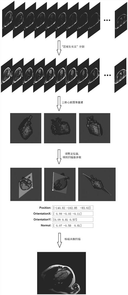 Heart three-dimensional positioning method based on MR horizontal axis image segmentation