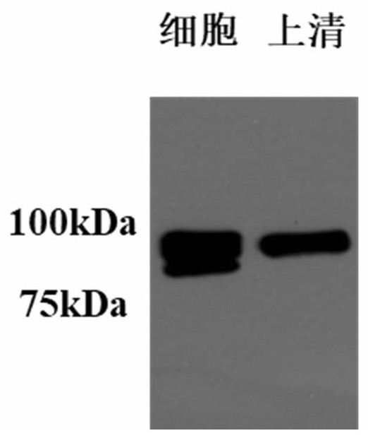 Stable coronavirus recombinant protein dimer and its expression vector