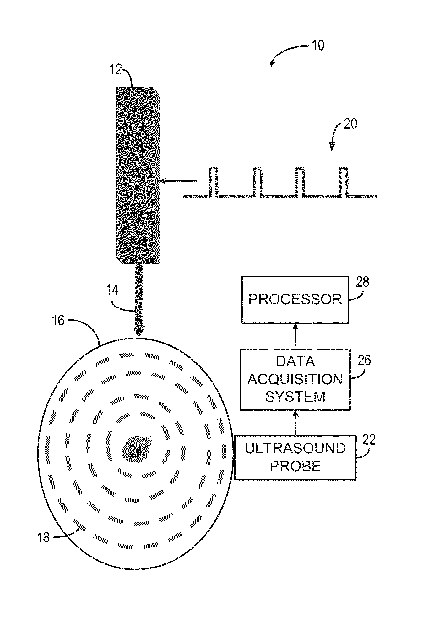 Systems and Methods for Real-Time Tracking of Photoacoustic Sensing